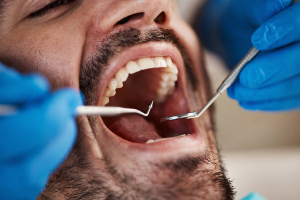 Best Walk-In Emergency Dental Services in Sylvan Lake, MI